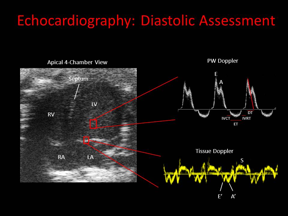 Echocardiography | Phenotyping Core